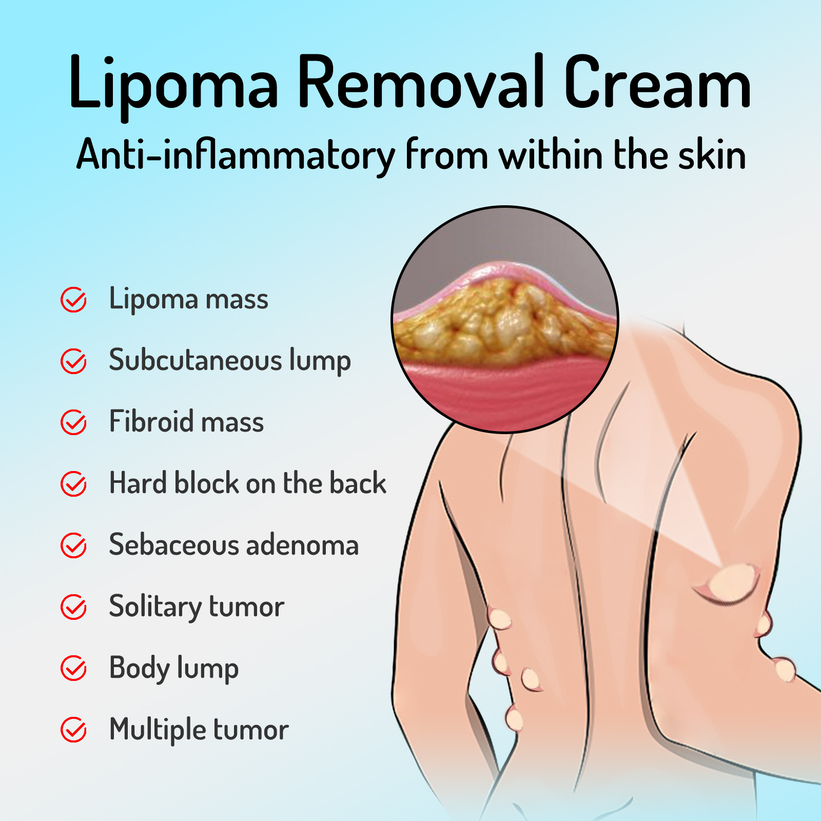 South Moon Lump allevia i tumori sottocutanei dei grumi di grasso e la crema per la cura del corpo schiarente_voghion.com