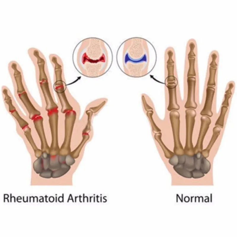 Fashion-Copper Therapy Half Finger Hand Pain Joint Relief Blood Circulation Gloves 1 Pair_voghion.com