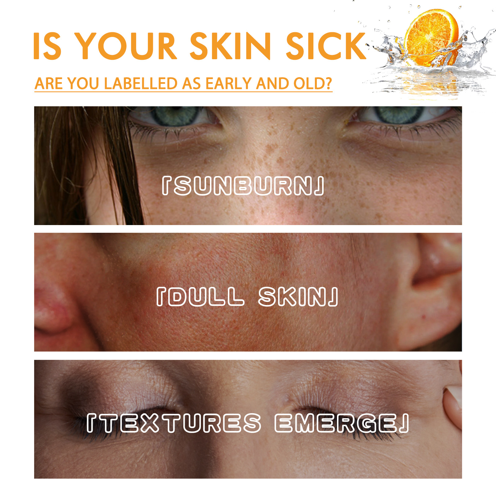 OUHOE Vitamin C Feuchtigkeitsspendende und aufhellende Haut Aufhellende Feuchtigkeitsspendende und straffende Essenz_voghion.com