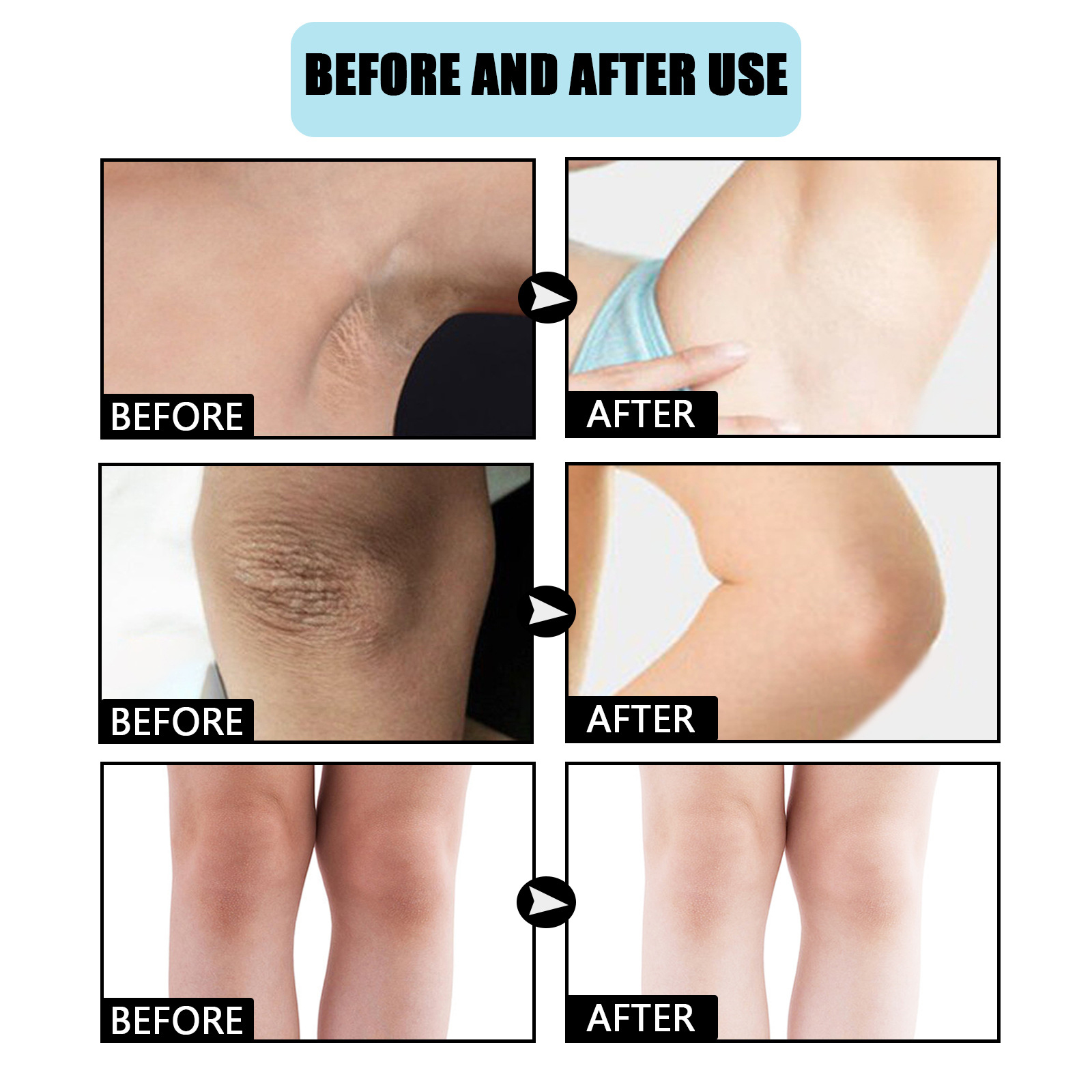 EELHOE Brightening Cream, Moisturizing Knee Elbow Concealer Moisturizing Delicate And Brightening Body Lotion_voghion.com