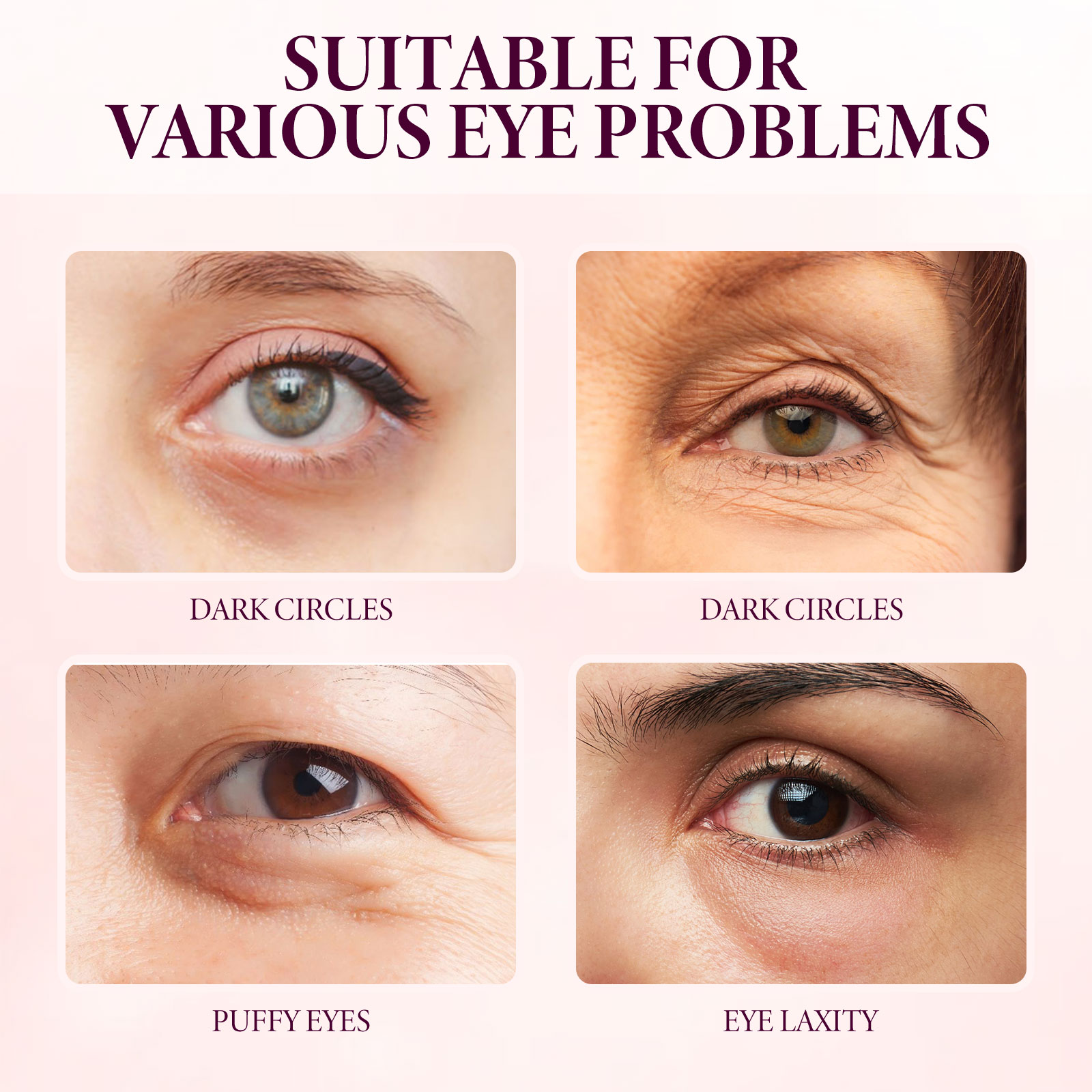 EELHOE Mango Eye Cream Reduces Fine Lines Of Crow's Feet Bags And Gently Nourishes Elasticity And Tightens The Skin Around Eyes_voghion.com